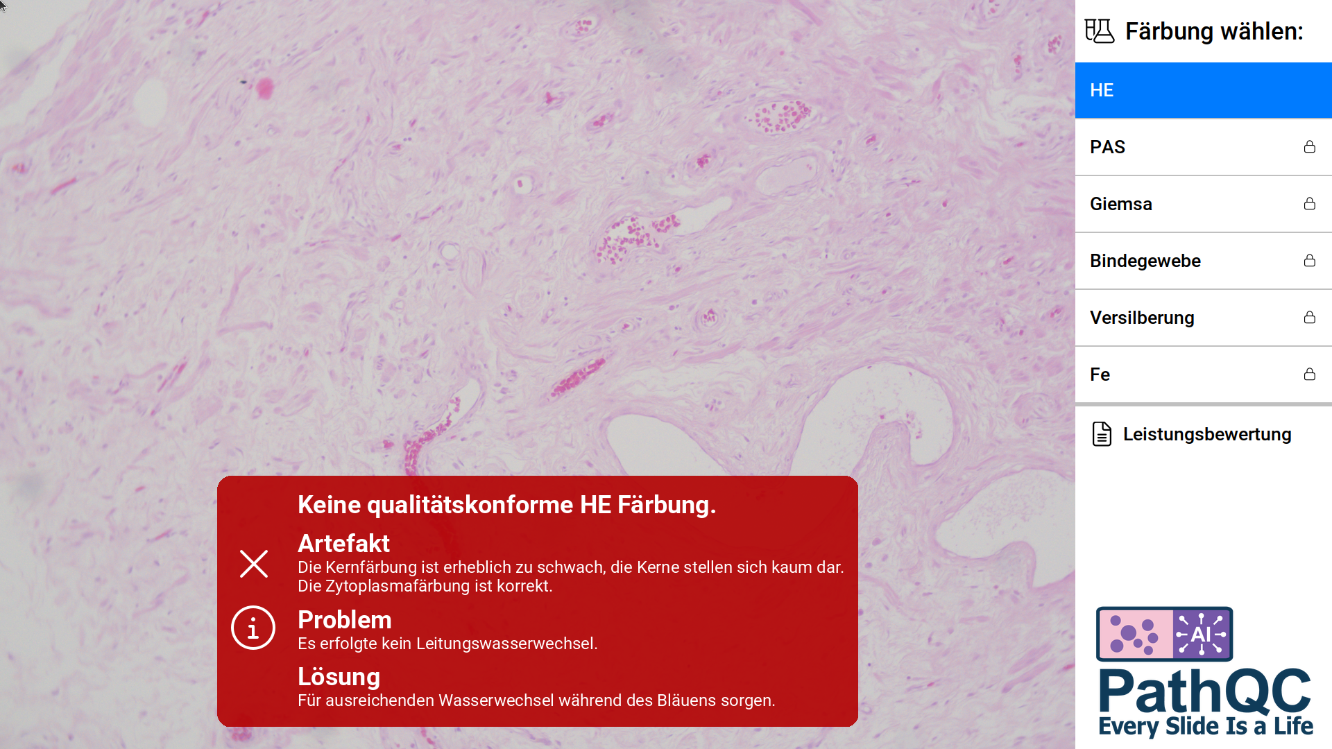 HE Färbung nicht in Ordnung