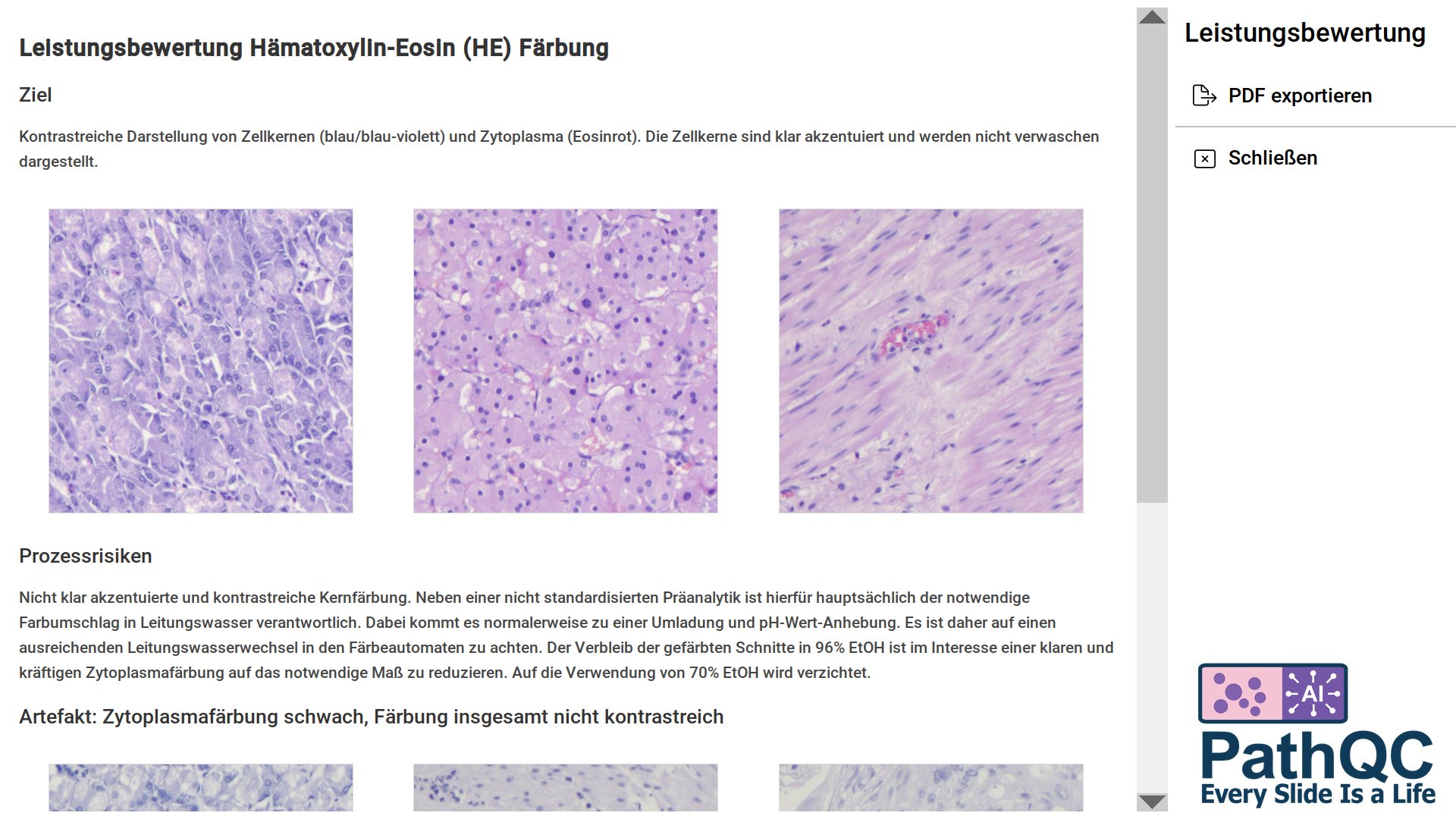IVD-R konforme Leistungsbewertung