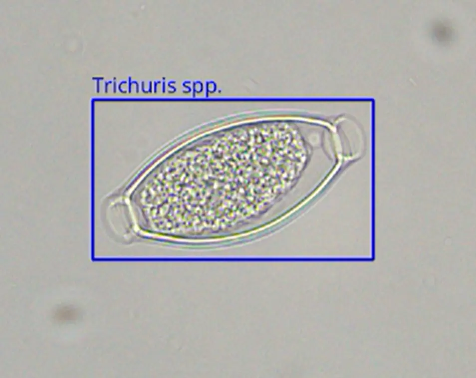 Trichuris